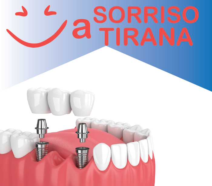 SORRISO A TIRANA